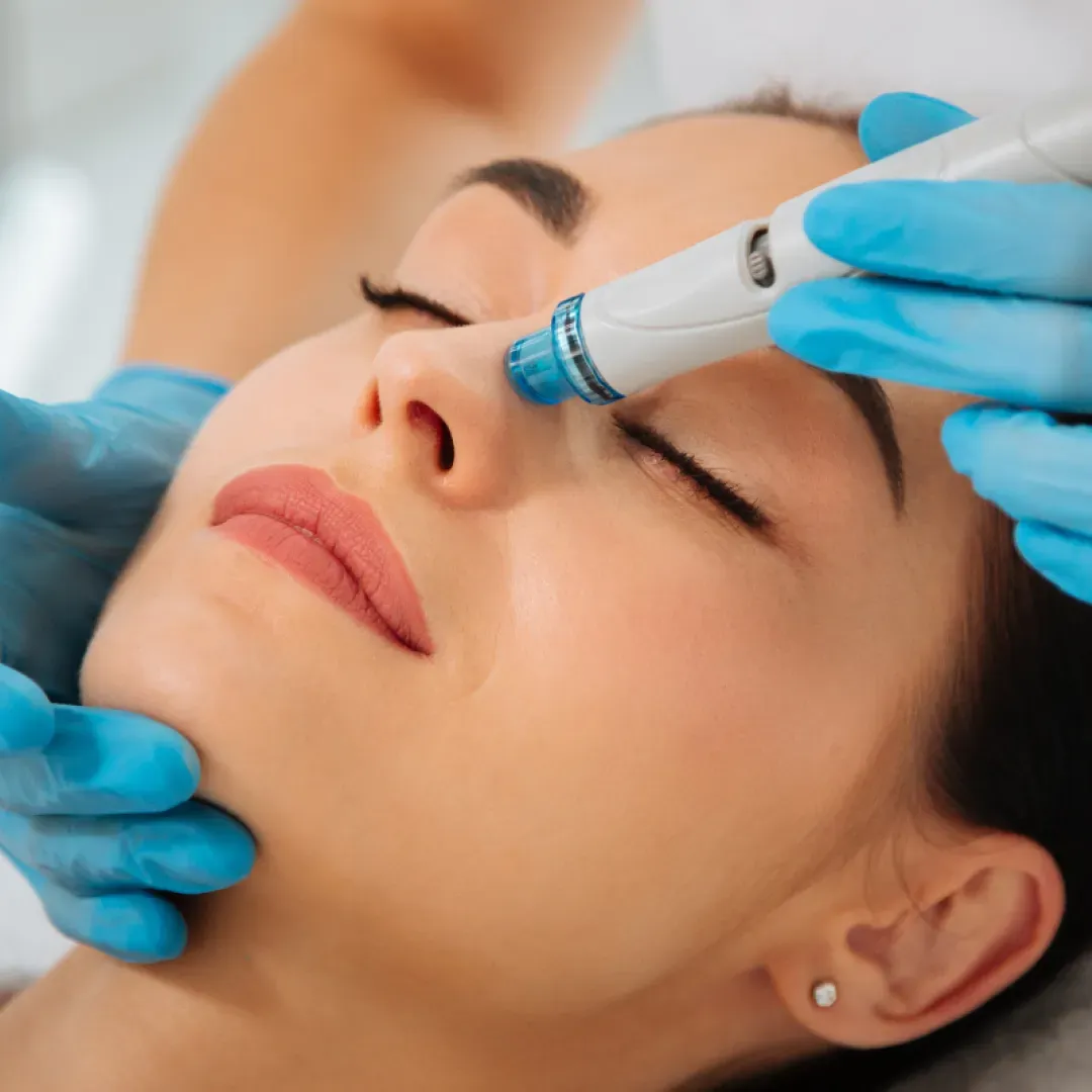 HydraFacial Syndeo