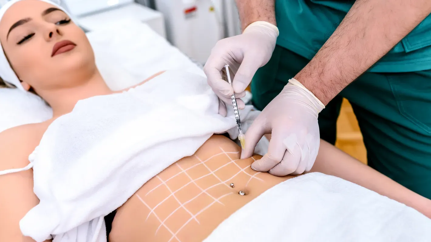 lipoliza-injectabila-1 lipoliza-injectabila-1.webp